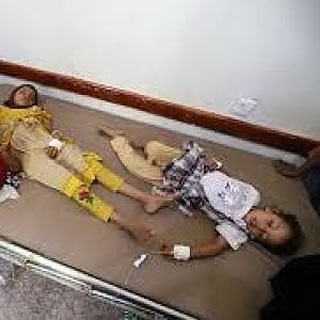 Yemen: almeno 78 bambini sono morti a causa della dengue