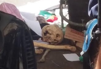 Roma tuscolano: ossa umane rinvenute in un cassonetto