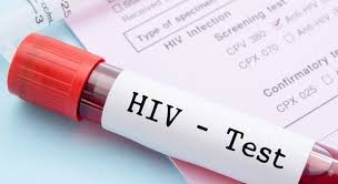 Hiv: potrebbero aumentare le persone contagiate da Valentino T.